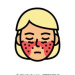 systemic lupus erythematosus color icon 260nw 2083143565